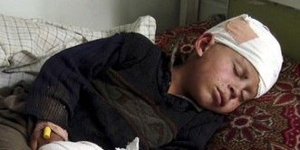 کنر: جنایت جنگی نیروهای بین المللی