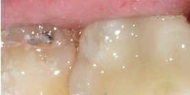 دندانهای آقای معروفی ریخت